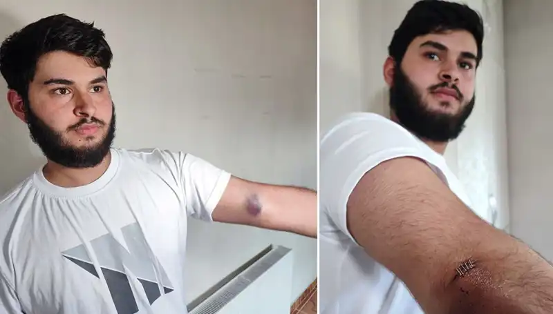 Bahçeye Kaçan Top, Mahallede Hayatı Durma Noktasına Getirdi!