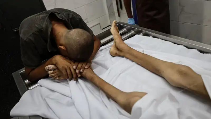 Gazze'de Açlık Tehlikesi: Bir Çocuğun Hayatını Kaybetmesi Tüm Dünyayı Sarstı
